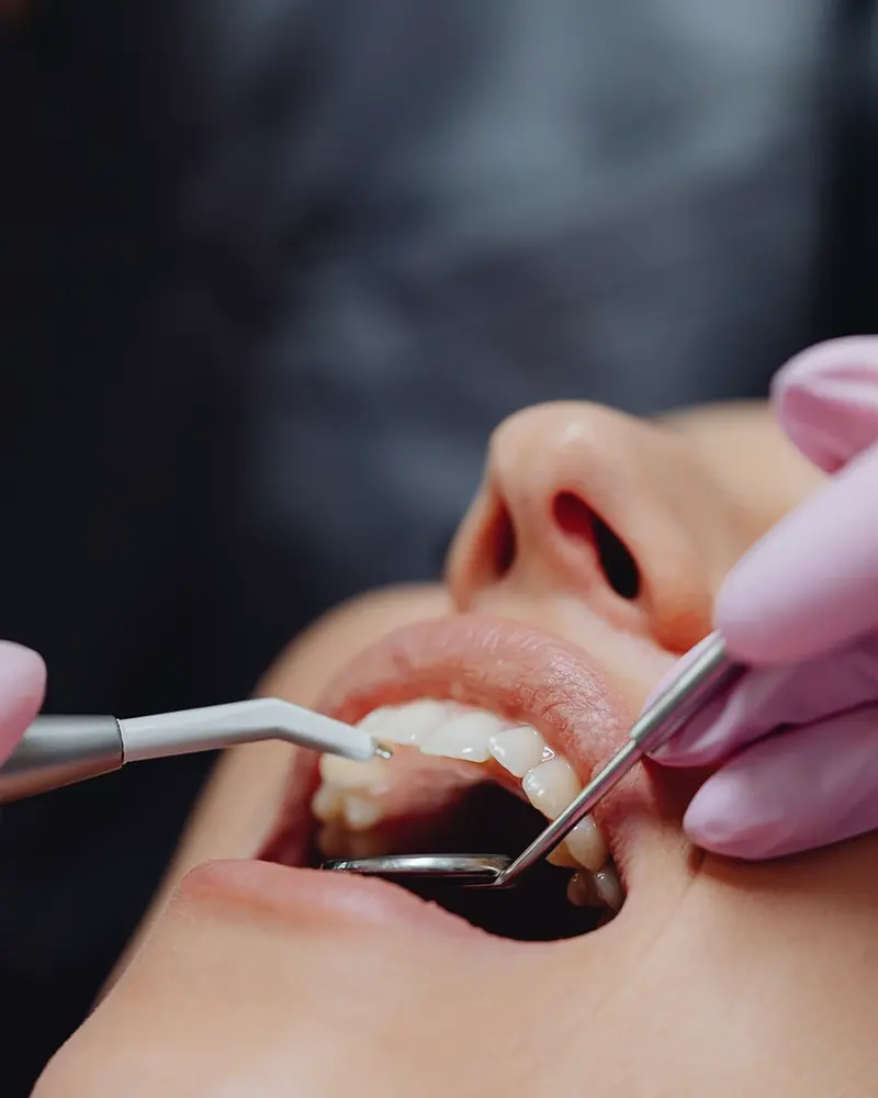 Dentista com luvas realizando procedimento odontológico em close